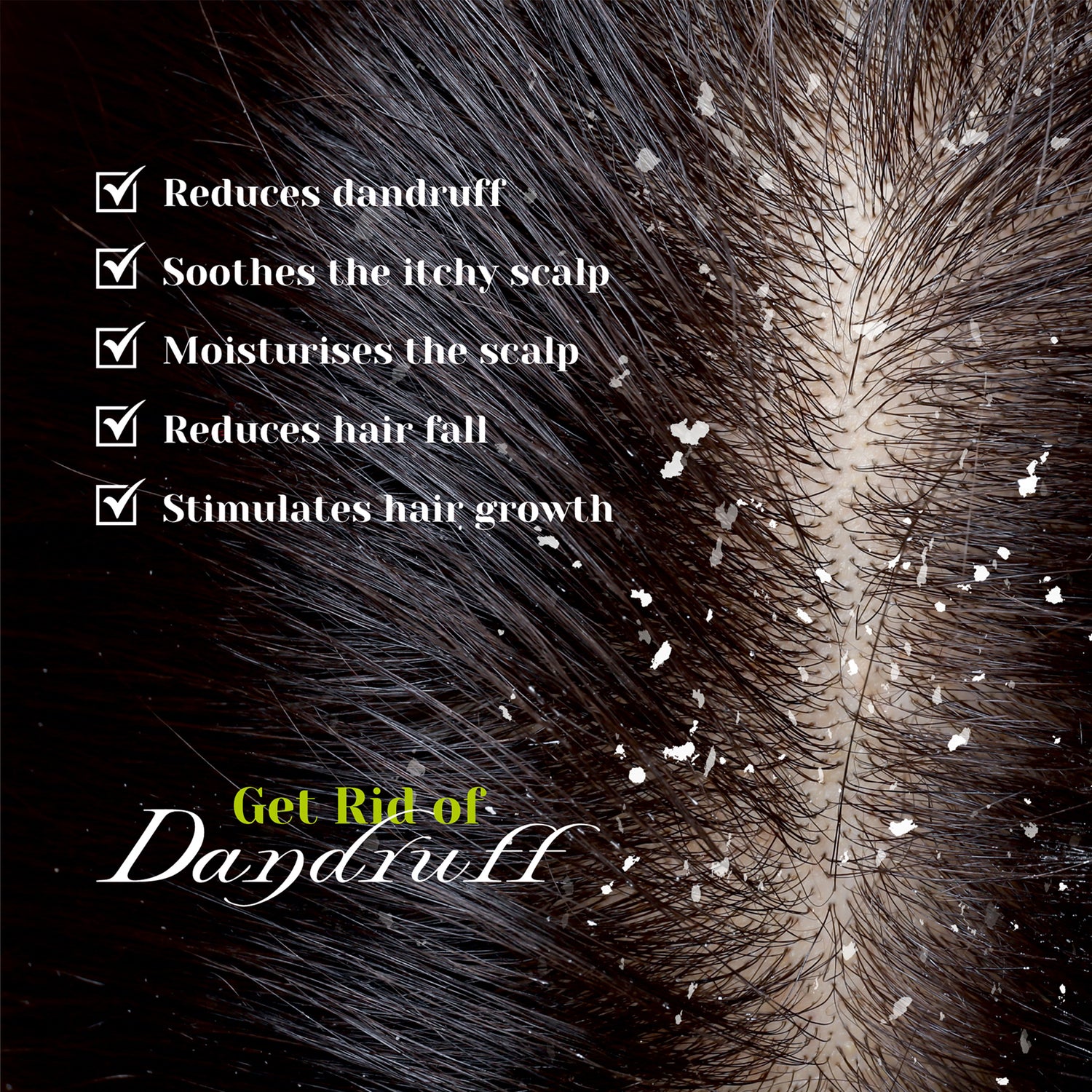 Anti Dandruff oil (Durdhurapatradi Tailam) - Reduces dandruff and strengthens the root